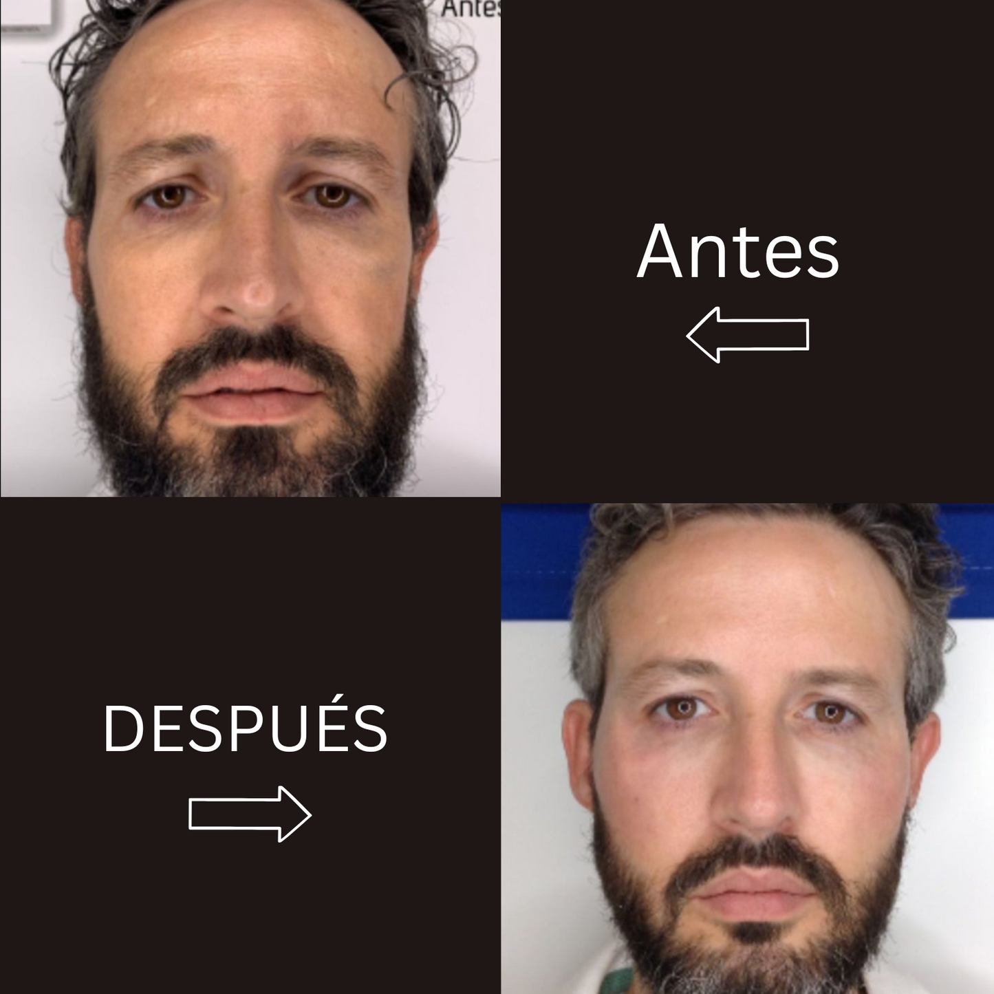 KIT CUIDADO INTENSIVO MASCULINO PREMIUM