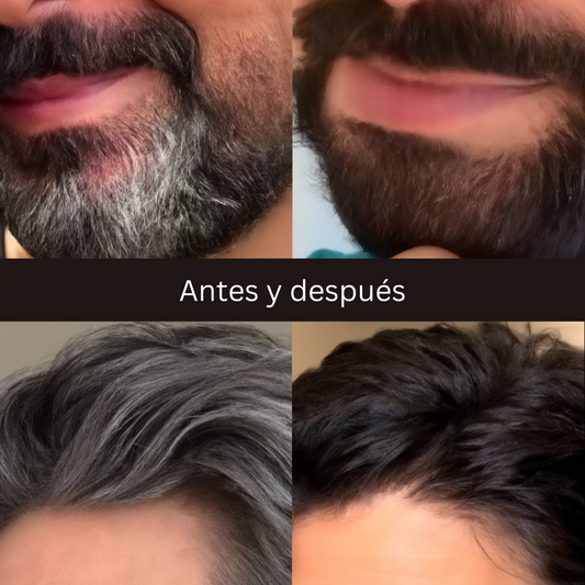 Shampoo Anticanas