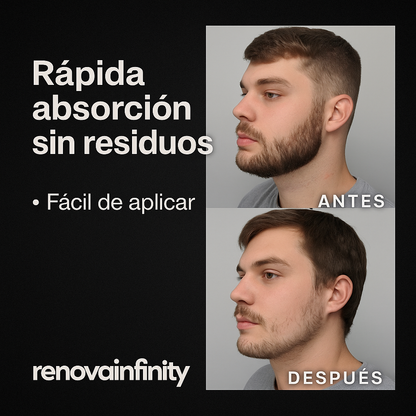 BÁLSAMO PARA CRECIMIENTO DE BARBA ULTRAPOTENTE | MINOXIDIL 20% + BIOTINA + BERGAMOTA + CÉLULAS MADRES + INGREDIENTES PREMIUM | 100ml