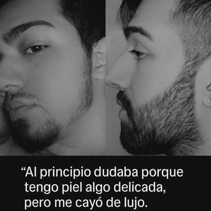 BÁLSAMO PARA CRECIMIENTO DE BARBA ULTRAPOTENTE | MINOXIDIL 20% + BIOTINA + BERGAMOTA + CÉLULAS MADRES + INGREDIENTES PREMIUM | 100ml