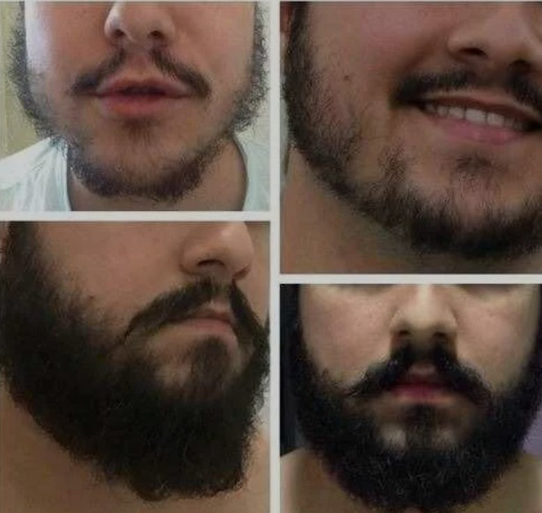 BÁLSAMO PARA CRECIMIENTO DE BARBA ULTRAPOTENTE | MINOXIDIL 20% + BIOTINA + BERGAMOTA + CÉLULAS MADRES + INGREDIENTES PREMIUM | 100ml