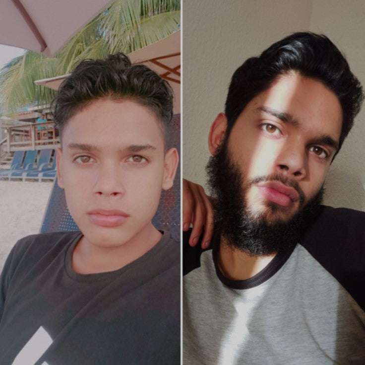 files/balsamo_antes_y_despues_7.jpg
