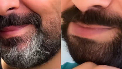 SHAMPOO ANTICANAS/ANTIEDAD CABELLO Y BARBA DE ÓRGANO + NOGAL + ROMERO | 250ML